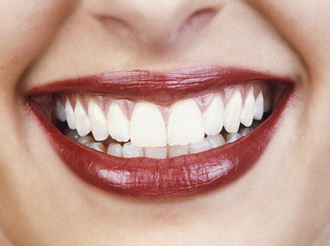 پودر سفید کننده دندان ایماک