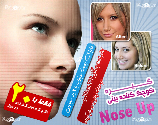 گيره فرم دهنده و كوچك كننده بيني  Nose UP