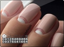 کاشت و ژلیش