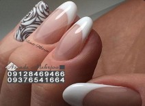 کاشت و ژلیش فرنچ و طراحی