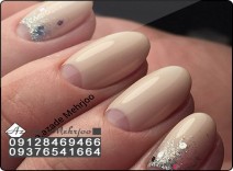کاشت پودر با طراحی ژلیش