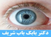 ضد آفتاب رنگی دور چشم مای