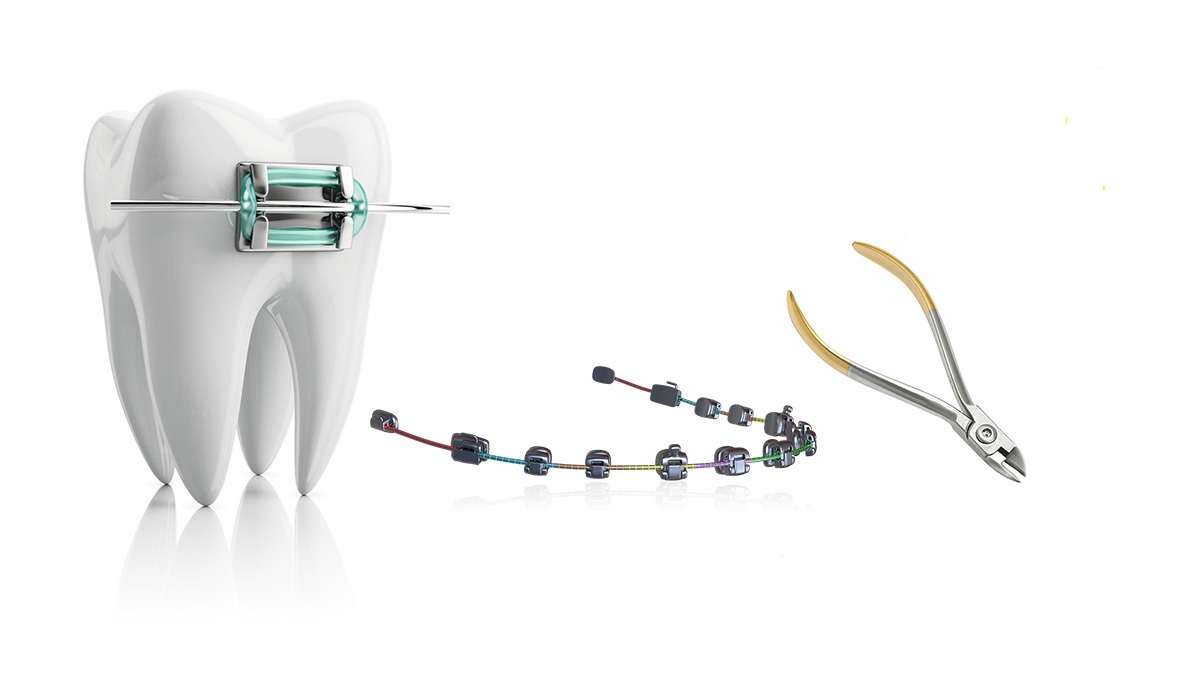 ارتودنسی دندان کج چگونه انجام می شود؟