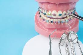 برای حفظ بهداشت دهان و دندان در طول ارتودنسی چه کنیم؟