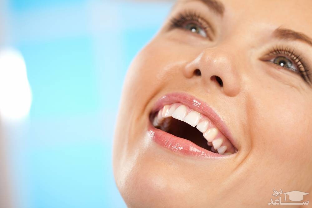 نکات مهم که باید قبل از بلیچینگ دندان بدانید
