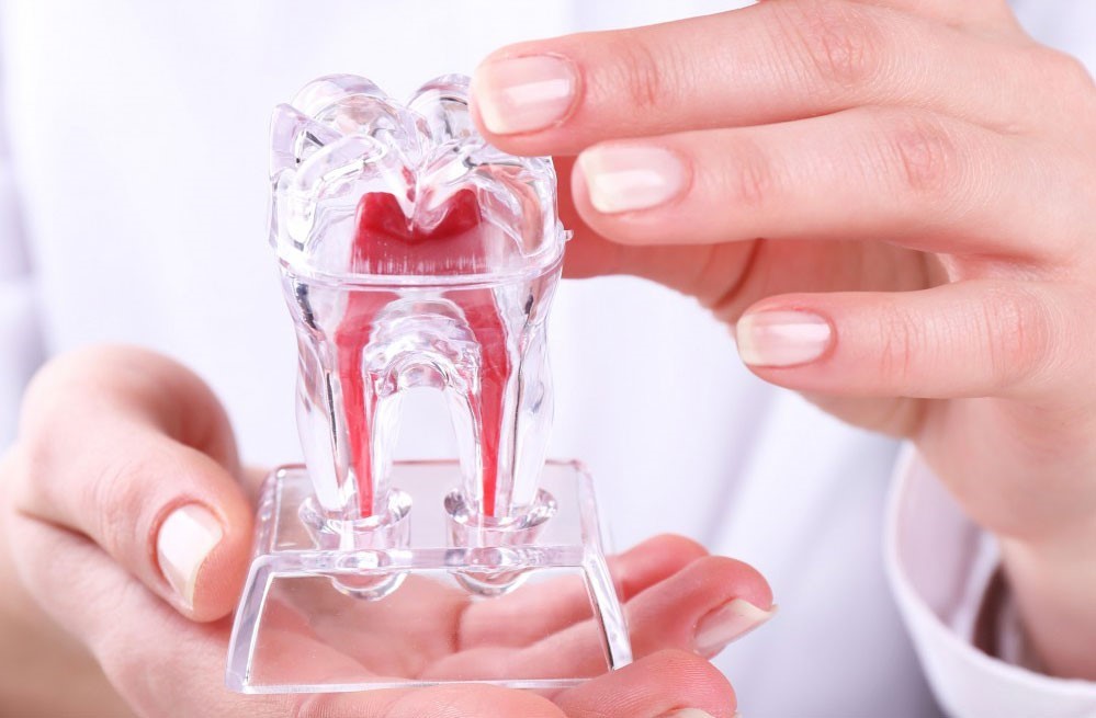 جوانب مثبت و منفی کاشت دندان با مینی اسکرو دندان چیست؟