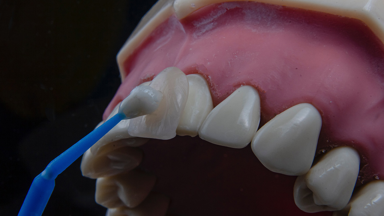 آیا ارتودنسی با کشیدن دندان درد دارد؟