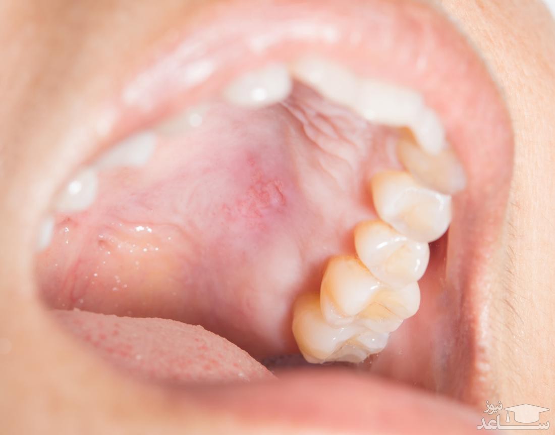 بهترین دکتر کامپوزیت دندان چه ویژگی هایی دارد؟