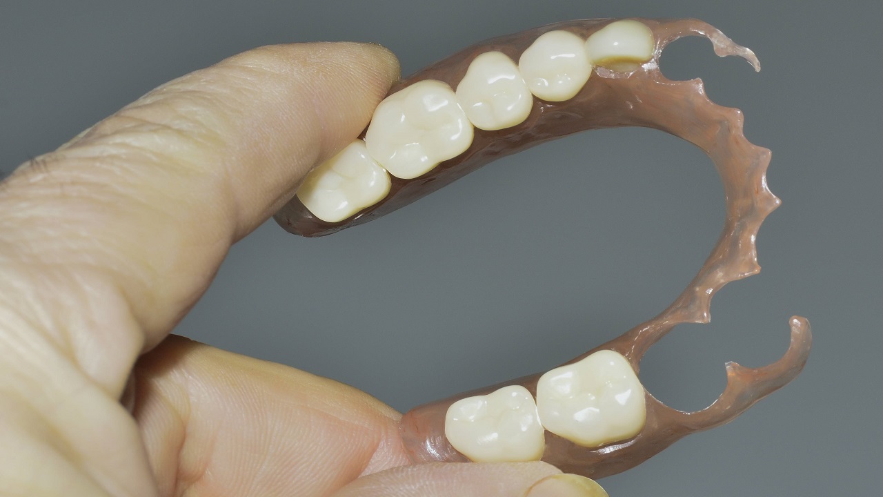 دندان مصنوعی تکه ای یا پارسیل + مزایا و معایب آن