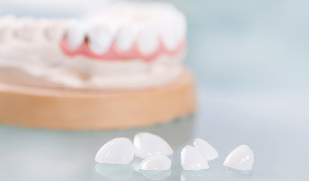 موکوسل، آبسه دندان و بلیچینگ دندانپزشکی: راهنمای جامع برای سلامت دهان و دندان