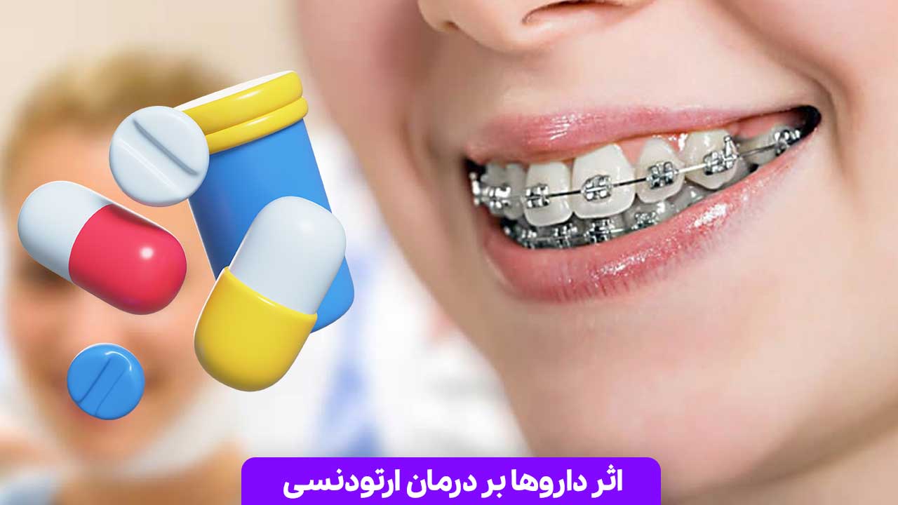 اثر داروها بر درمان ارتودنسی: چگونه داروها می‌ توانند روند درمان را تحت تأثیر قرار دهند؟