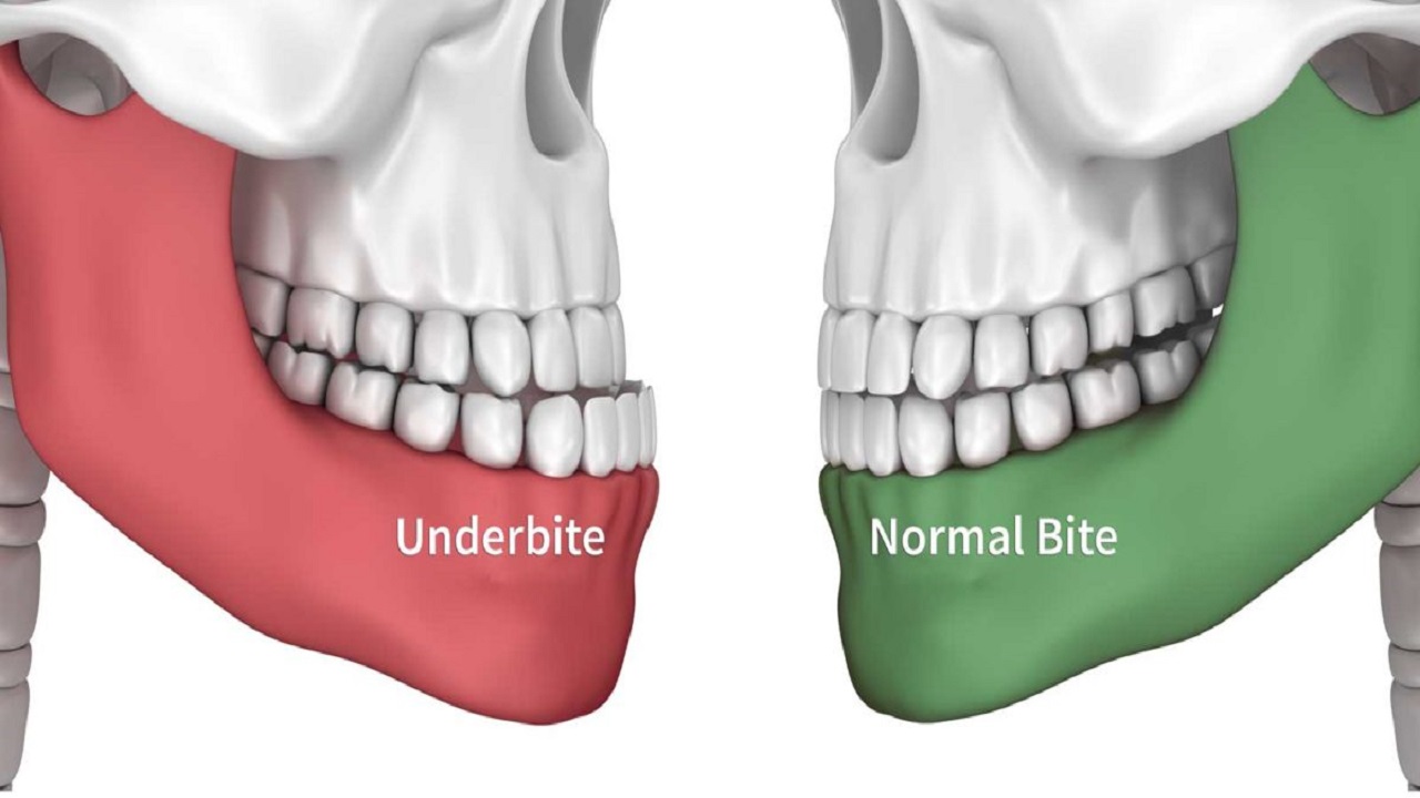 چه مشکلاتی با ارتودنسی دندان قابل حل هستند؟
