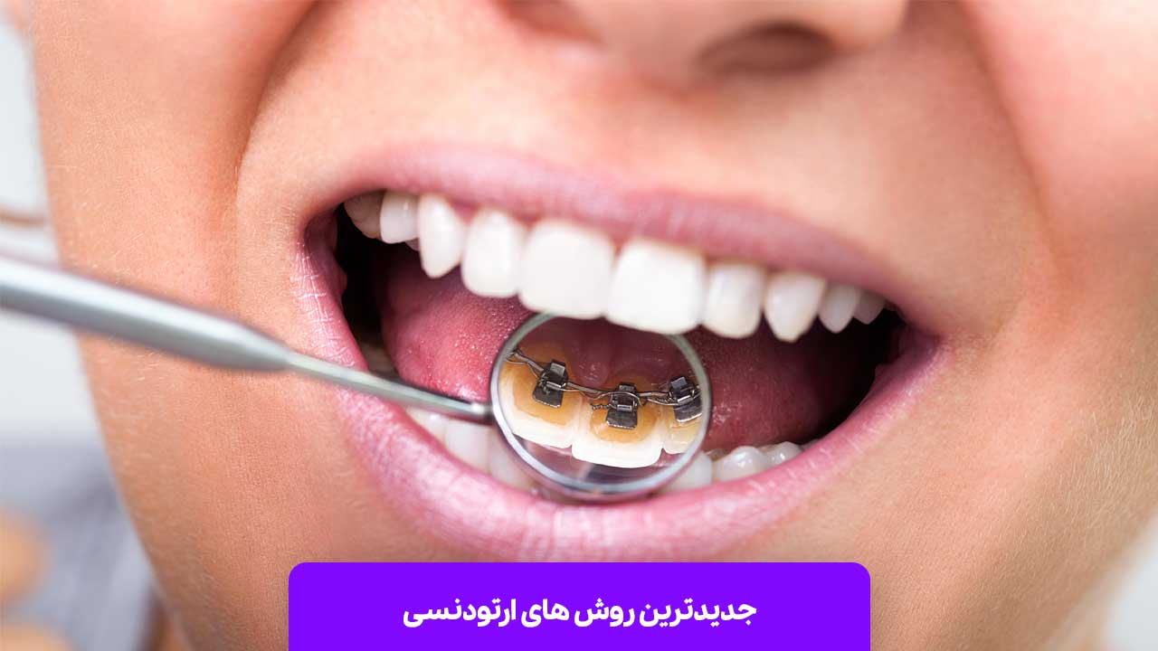 جدیدترین روش‌ های ارتودنسی: پیشرفته‌ ترین تکنیک ‌ها برای بهبود لبخند شما