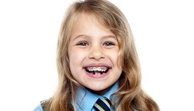 ارتودنسی دندان کودکان: مزایا، معایب، سن مناسب و انواع