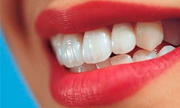 مضرات خوردن تنقلات برای دندان